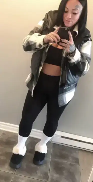 Antalya’daki Estetik Operasyonu Felaketle Bitti 4